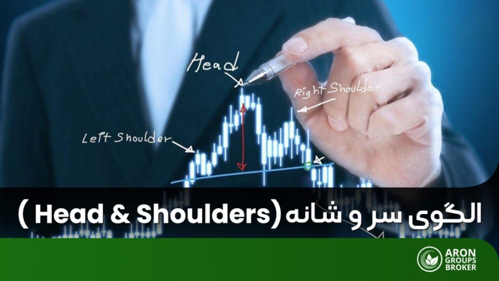 الگوی سر و شانه
